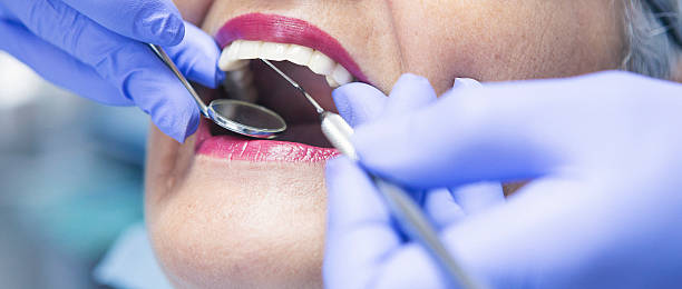 Best Cosmetic Emergency Dentistry in Springfield, TN